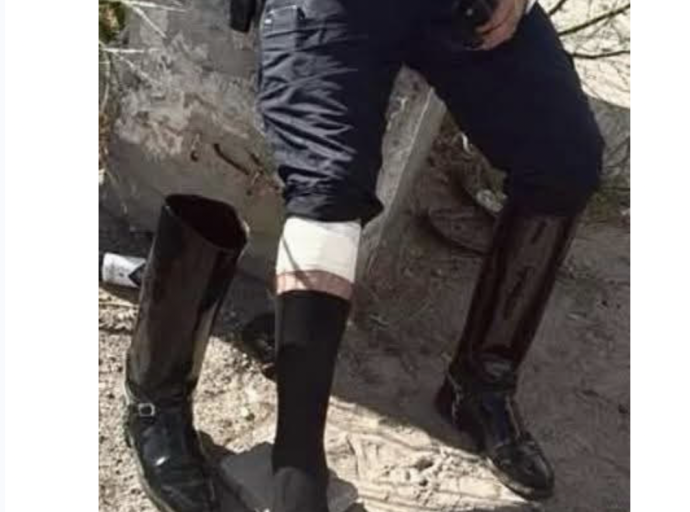Saben de Que Pata Cojea